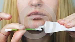 A woman puts on the lips ointment from herpes