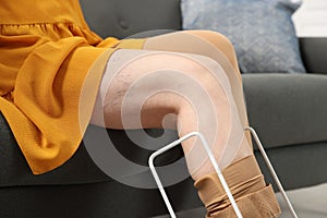 Woman putting on compression tights with stocking donner in living room, closeup. Prevention of varicose veins