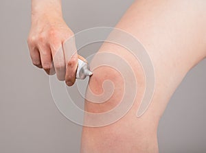 Woman putting pain relieving cream on knee. Leg injury concept. Bruise, sprain, arthritis healing. Health problems