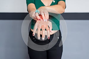 Woman with rash or papule and scratch on her arm from allergies,Health allergy skin care problem,Close up