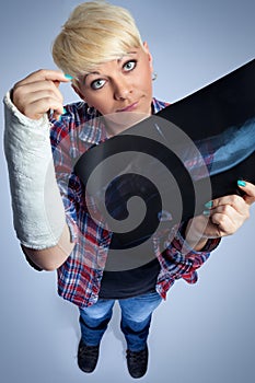 Woman with x-ray of her broken arm