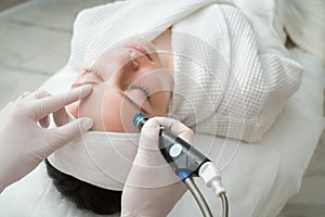 A woman receives laser treatment of the face in a cosmetology clinic, a concept of skin rejuvenation is being developed