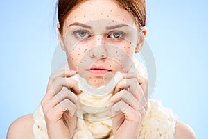 woman with red dots on her face with a scarf dermatology skin problems