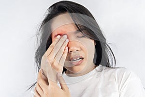 A woman with red eyes and a black face. She is holding her face and rubbing her eyes