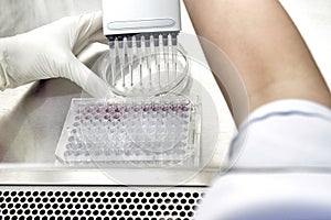 He woman researcher using multichannel pipette 8-channel pipette