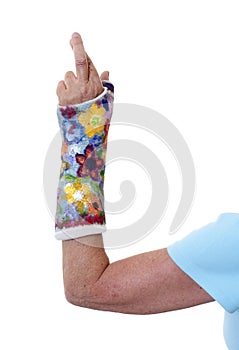 Woman's arm in painted cast