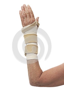 Woman's bandaged arm isolated on white