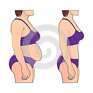 Woman s body before and after weight loss. Vector illustration.
