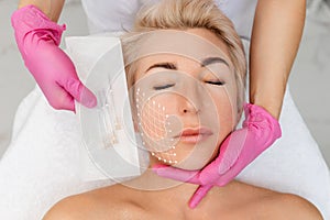 Woman& x27;s face with arrows on a cosmetology procedure of thread lifting. Cosmetologist shows the needles for the