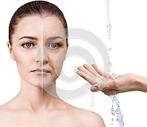 Woman`s face before and after rejuvenation.