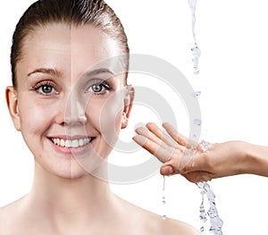 Woman`s face before and after rejuvenation.