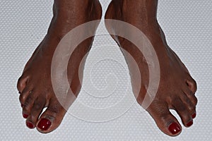 Woman& x27;s feet turned outwards