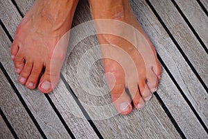 Woman's foot. Hammer toes on the deck of a sailing boat.