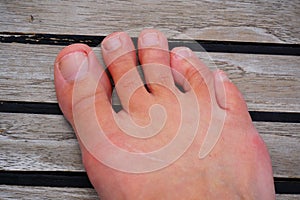 Woman's foot. Hammer toes on the deck of a sailing boat. Bare feet. photo