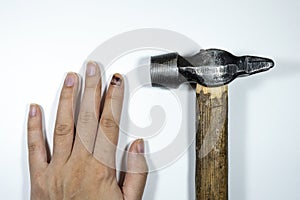 Woman`s hand working with hammer. Bruise on nail