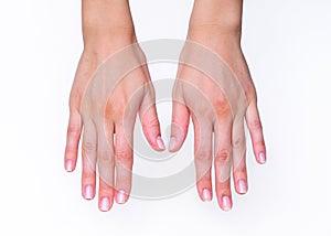 Woman's Hands Facing Down