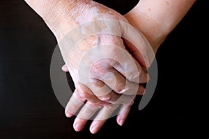 Woman`s hands folded.