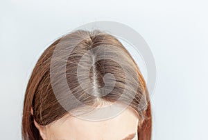 A woman's head with a parting of gray hair