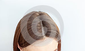 A woman's head with a parting of gray hair