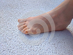 Woman`s legs with a plasters to a callus on toes. Foot skin care and prevention of corns, calluses. First aid for cuts skin.