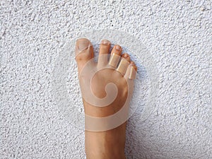 Woman`s legs with a plasters to a callus on toes. Foot skin care and prevention of corns, calluses. First aid for cuts skin.