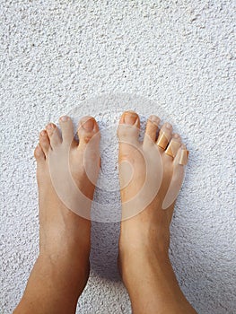 Woman`s legs with a plasters to a callus on toes. Foot skin care and prevention of corns, calluses. First aid for cuts skin.