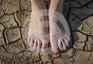 Woman`s legs are standing on cracked earth. The concept of dry skin of the feet and lack of moisture, fungal diseases