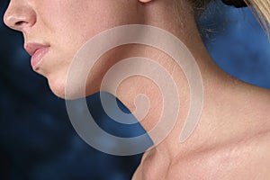 Woman's neck and chin