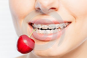 Woman`s teeth with braces biting off ripe cherry photo