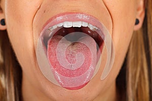 Woman`s tongue