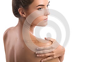 Woman with a scar on her shoulder