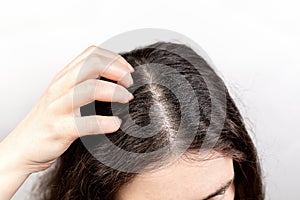 The woman scratches her head with her hand, showing a parting of dark hair with dandruff. Close up. The view from the top. White