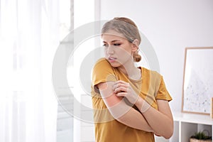 Woman scratching arm indoors. Allergy symptoms