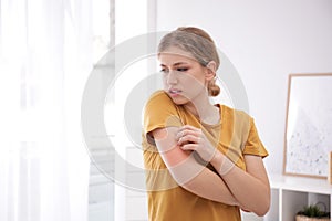 Woman scratching arm indoors. Allergy symptoms photo