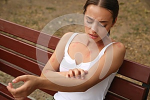 Woman scratching arm with insect bite outdoors