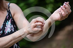 Woman scratching her arm