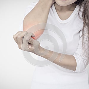 Woman scratching her elbow.