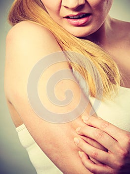 Woman scratching her itchy arm with allergy rash