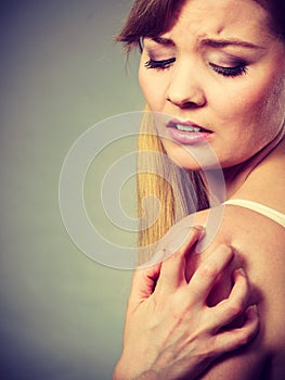 Woman scratching her itchy arm with allergy rash