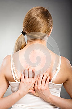 Woman scratching her itchy back with allergy rash