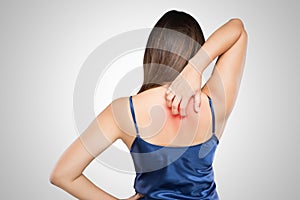 Woman scratching her itchy back with allergy rash