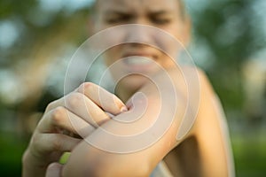 A woman scratching her itchy mosquito bite. Tropical climate danger