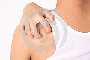 Woman scratching her shoulder and neck because of dry skin