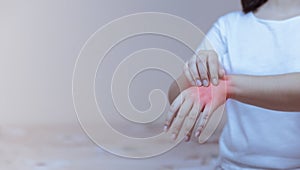 Woman scratching the itch on her hands allergic reaction to insect bites, dermatitis, food, drugs.