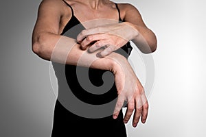 Woman scratching itchy skin on hands