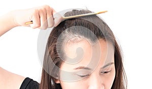 Woman serious hair loss problem for health care shampoo and beau