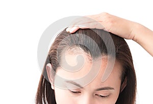 Woman serious hair loss problem for health care shampoo and beau