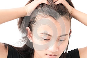 Woman serious hair loss problem for health care shampoo and beau