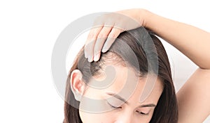 Woman serious hair loss problem for health care shampoo and beau