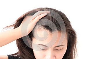 Woman serious hair loss problem for health care shampoo and beau